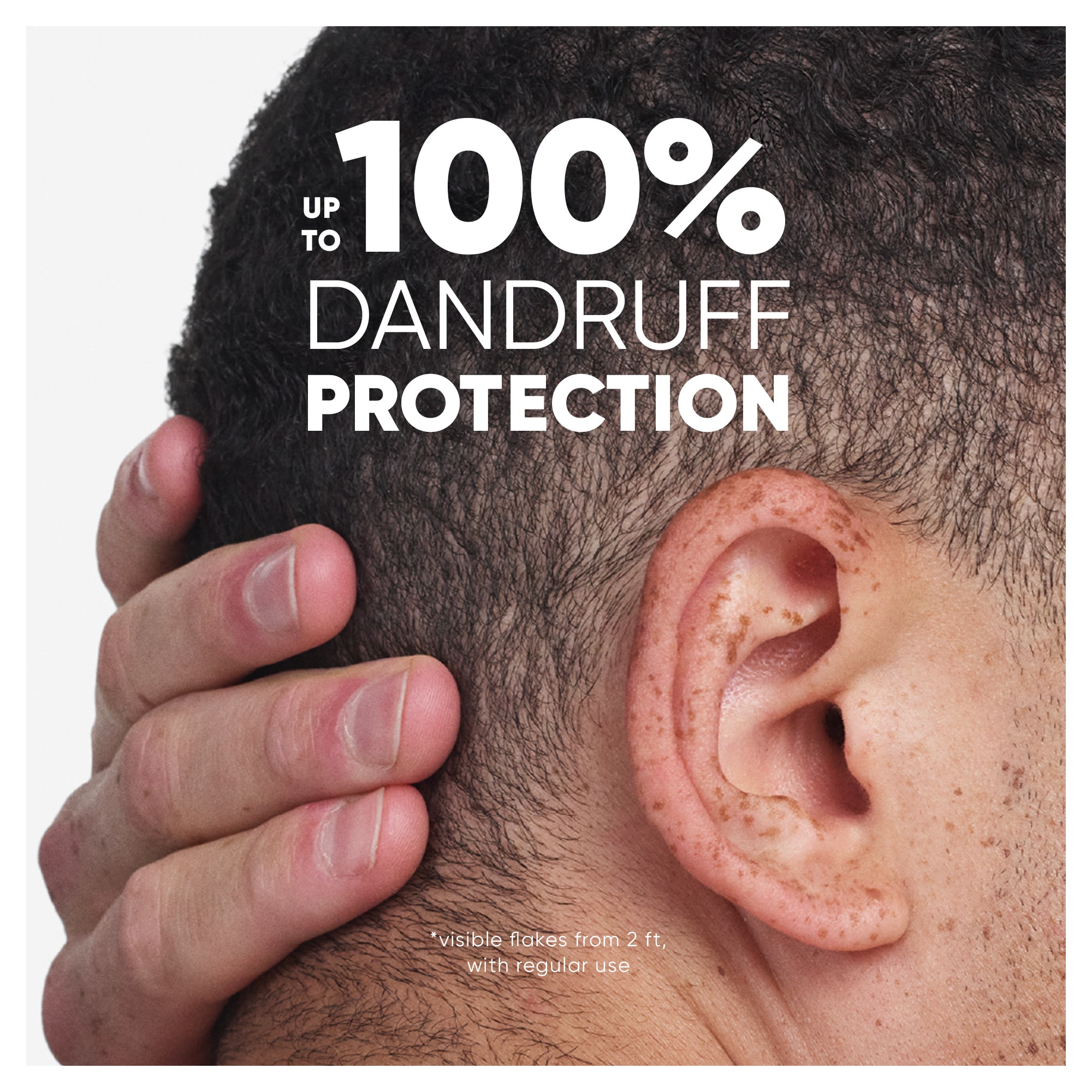 up to 100% dandruff protection