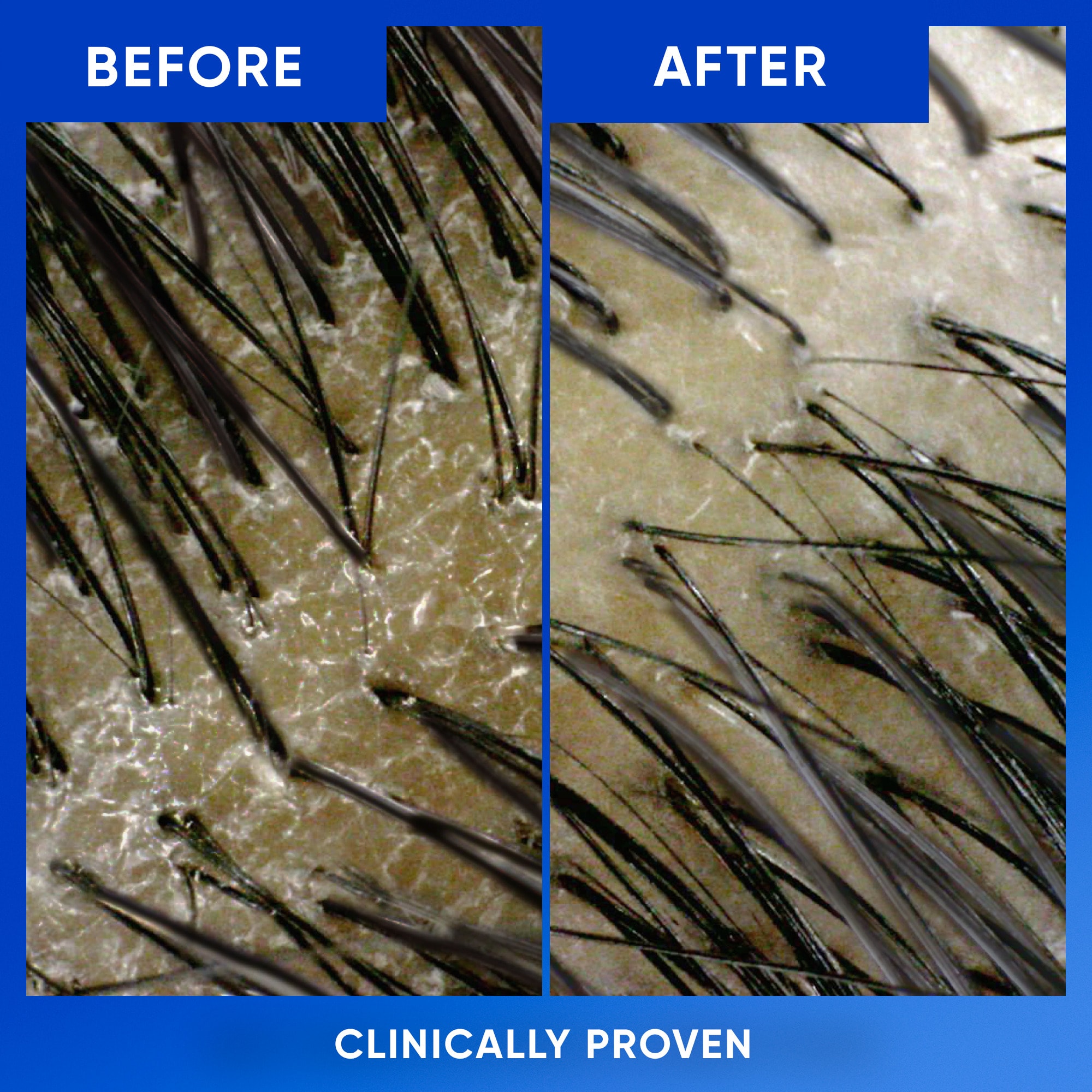 before/after